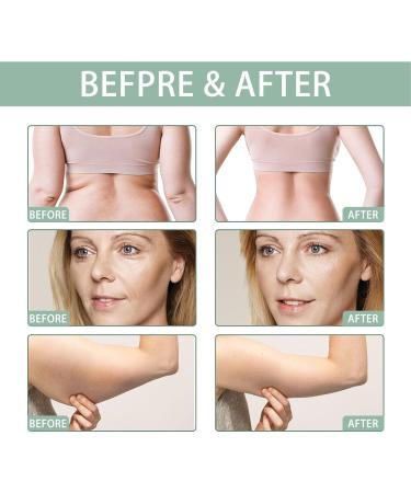 3-Piece Slimming Oil Set - Fat Burning Massage Oil for Body Shaping & Tightening - 30ml for Arms Legs & Stomach - Buy Online on GoSupps.com