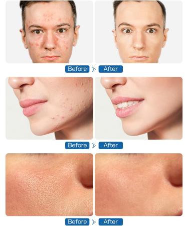 3-in-1 Waterproof Facial Cleansing Brush | Rechargeable Silicone Face Massager for Men & Women | Electric Exfoliating Brush for Blackhead Removal - Buy Online on GoSupps.com