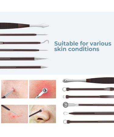 15 PCS Pimple Popper Tool Kit | Blackhead Remover & Acne Extractor Set with Metal Case - Buy Online on GoSupps.com