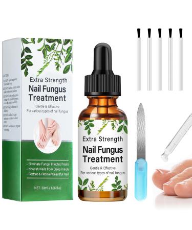 Fungal Nail Treatment Toenail Fungus Treatment Extra Strong Nail Repair Solution for Toenails & Fingernails Protects Thick Broken And Discolored Nails Restoring Healthy Nails 30ML Green-1