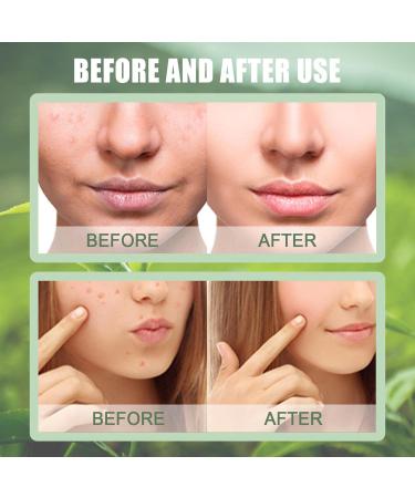 Green tea stick Natural Purifying Clay Masque Blackhead Remover with Green Tea Extract Skin Face Moisturizer for all skin types facial care products Qihuyi - Buy Online on GoSupps.com