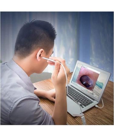 RMENST Ear Wax Removal Tool | HD Visual Ear Camera Cleaner Endoscope - Buy Online on GoSupps.com