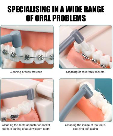 Interspace Toothbrush Set - 12 Soft Narrow Interdental Brushes for Orthodontic Braces & Detailed Cleaning - Buy Online on GoSupps.com