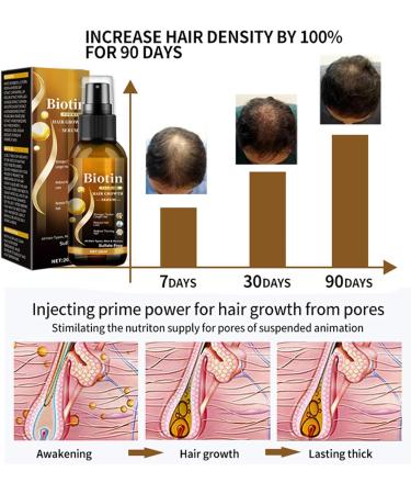 Hair Growth Spray - Hair Growth Serum with Biotin - Hair Serum for Hair Growth - Hair Loss Treatment For Men Women - Biotin Thickening Herbal Serum - Biotin Premium Herbal Serum - 20ml - Buy Online on GoSupps.com