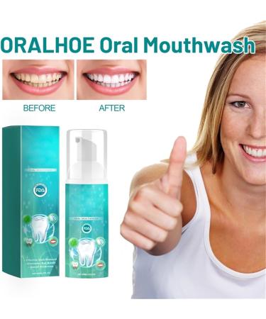 Furzero Smartsmile Mouthwash - 60ml Total Care Oral Rinse for Healthy Teeth (2PC) | Buy Internationally - Buy Online on GoSupps.com
