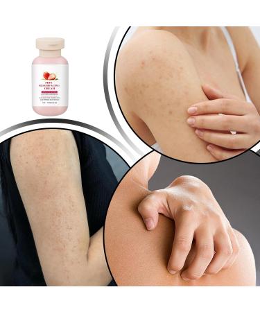  ETUCYNG Strawberry Skin Lotion 100ml Body Scrub Strawberry Skin Cream For Legs - Softening Moisturizing Body Lotion For Chicken Neck Arms Legs Face - Buy Online on GoSupps.com