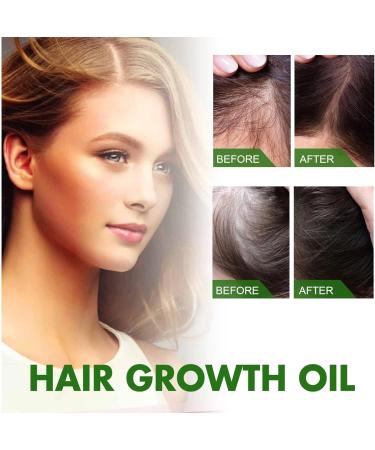 JITASHWA Hair Growth Oil Hair Growth Essence Repair Hair Follicles Hair Loss Prevention Hair Regrowth Treatment Hair Thickening Product - Buy Online on GoSupps.com