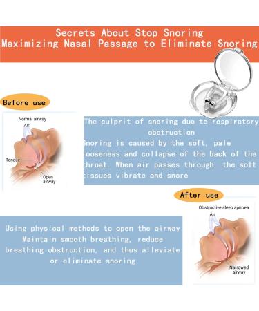 Buy Silicone Magnetic Anti-Snoring Device | 8-Pack Snoring Solution for Men & Women | Stop Snoring Easily - Buy Online on GoSupps.com