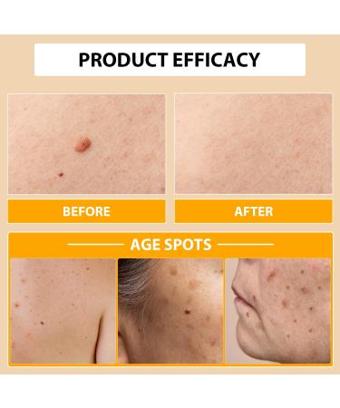 Buy Bee Venom Correcting Cream - Hydrating Spot Removing Moisturizer for Women (2 Bottles) - International Shipping Available - Buy Online on GoSupps.com