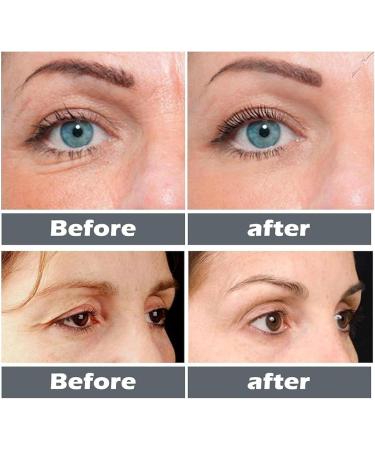  3Pcs Recombinant Collagen Anti-Wrinkle Serum Collagen Boost Anti-Aging Serum Collagen Boost Anti-Aging Serum Diminish Wrinkles Enhance Collagen For All Skin Types 26ml - Buy Online on GoSupps.com