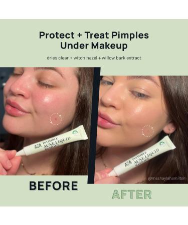AOA Skin Invisible Acne Liquid Patch - Invisible Spot Treatment with Witch Hazel & Salicylic Acid Liquid Pimple Patch Clear Fits to Makeup | 0.42 Fl Oz 12g - Buy Online on GoSupps.com