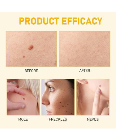 eltolent Bee Venom Skin Restoration Cream Professional Bee Venom Skin Cream Bees Venoms Comprehensive Creams Deeply Cleanses and Moisturizes Natural Skin Moisturizer for All Skins Types (2PCS) - Buy Online on GoSupps.com