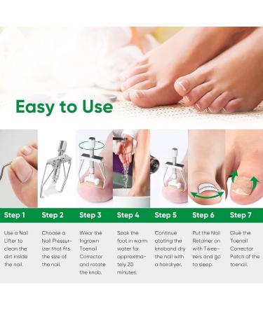 Professional Ingrown Toenail Treatment Kit | 50 PCS Corrector Patches, 4 PCS Toe Protectors - Buy Online on GoSupps.com