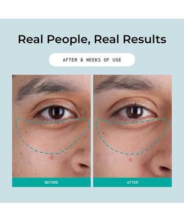 Bigger Than Beauty Skincare Defying Gravity Eye Lifting Cream Moisturizer with Plant Based Retinol for Women Green Tea and Essential Vitamins Daily Skin Care Routine Vegan Formula & Cruelty Free - Buy Online on GoSupps.com