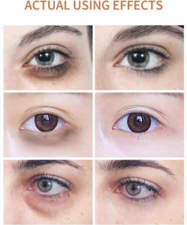 Retinol Eye Stick Retinol Eye Cream Smoothens Wrinkle Eye Cream for Puffy Eyes Eye Brightener Stick for Dark Circles Eye Balm Stick Reducing Fine Lines Eye Cream for Puffiness-15ml - Buy Online on GoSupps.com