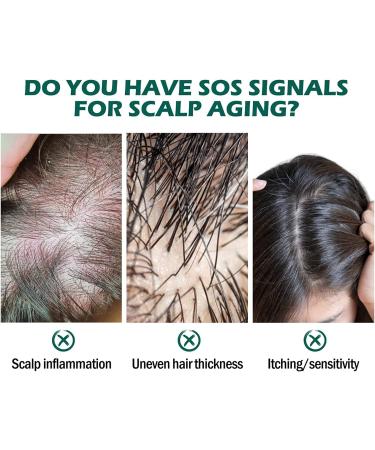 Scalp Folliculitis Treatment Oil Scalp Therapy Hair Oil Anti Hair Loss Treatment Serum Natural Therapy Oil for Hair and Scalp - Buy Online on GoSupps.com