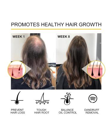PURC Hair Growth Oil - Natural Hair Density & Regrowth Essential Oil - 1.18oz - For Women & Men - Buy Online on GoSupps.com
