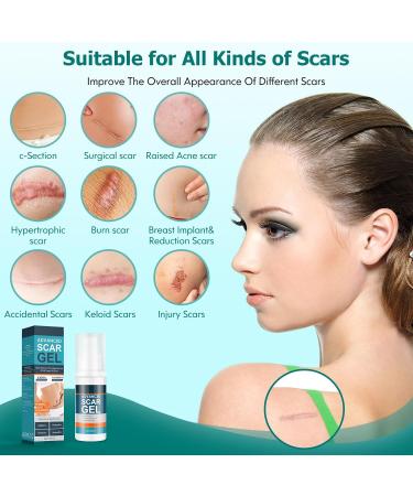 Advanced Scar Gel & Cream - Effective Scar Treatment for Surgical Scars Acne Burns Stretch Marks & Keloids - 1.76oz for Men & Women - Buy Online on GoSupps.com