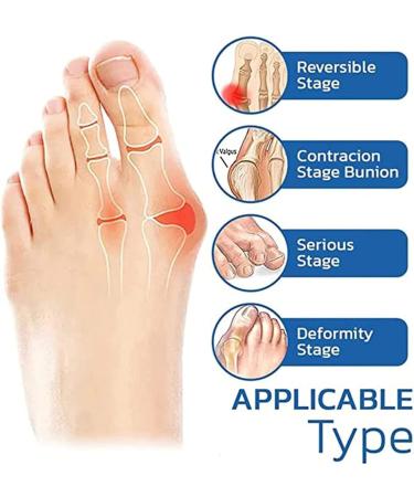 EXQST Orthopedic Bunion Relief Socks - Projoint Anti-Bunions Health Compression Toe Socks for Women - One Size Fits All - Buy Online on GoSupps.com