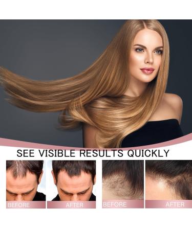 Hair Helper Spray 2024 New Rice Nutri Spray For All Hair Types (3 pcs) - Buy Online on GoSupps.com