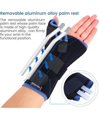 Velpeau Wrist Brace with Thumb Spica Splint for De Quervain's Tenosynovitis, Carpal Tunnel Pain - Medium Size, Right Hand - Buy Online on GoSupps.com