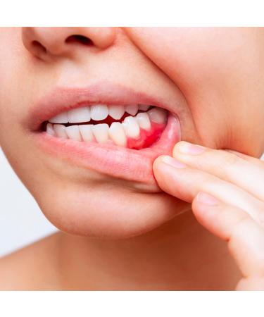  President President 4 ACTIVE TOOTHPASTE Gum Activity Kit For Irritated Inflamed and Periodontitis Gums Astringent Disinfectant Action RDA 50. 4 x 75 ml - Buy Online on GoSupps.com