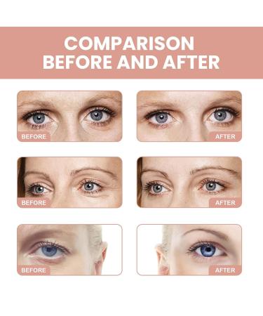 Retinol Eye Stick & Cream for Dark Circles | Anti-Aging Under Eye Balm | Reduce Puffiness & Fine Lines Fast - Shop Internationally - Buy Online on GoSupps.com