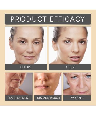 Bee Venom Anti-Wrinkle Cream Anti-Wrinkle Hydrating Moisturizing Light Lines Brightening Anti-Wrinkle Face Moisturizing Cream 20g (4PCS) - Buy Online on GoSupps.com