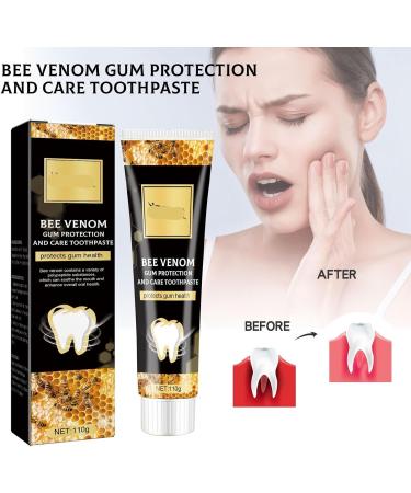 KLYso Advanced Gum Care Toothpaste - Whitening Tartar Control & Fresh Breath for Sensitive Gums(3PCS) - Buy Online on GoSupps.com