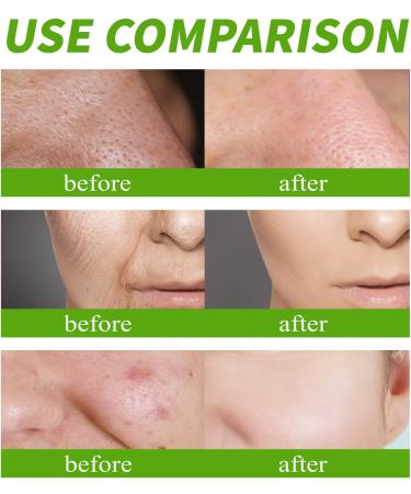 Nmbol Cream Instant Anti-wrinkle WL 1 - Buy Online on GoSupps.com