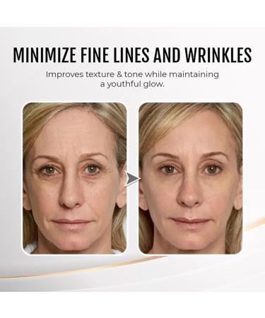 Instant Firm Eyes Cream Instant Iift Plus Dark Circles Instant Anti-Dark Circles and Wrinkle Cream Anti-Dark Circles/Puffiness Cream Instant Anti-Wrinkle Instant Lift+ Instant Lift Plus for Women Men (1) - Buy Online on GoSupps.com