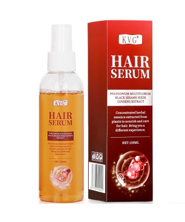 KVG Natural Hair Growth Spray Hair Growth Products of Hair Loss/Thinning/Damaged/Dry/Flaky/Oily Hair Loss Treatments for Women & Men (5.07 Fl.Oz) White