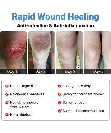 LMNOOP Wound Care Cream 1.1oz - First Aid Skin Repair Ointment for Infection Ulcers, Cuts, Scrapes, Burns, Bites & Surgical Wounds - Buy Online on GoSupps.com