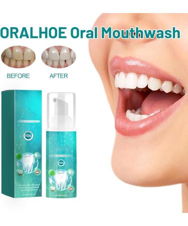 Discover Furzero Smartsmile & Prox Smile Shine - Teeth Whitening Mouthwash for Total Oral Care (2 PC) - Shop Now for International Shipping! - Buy Online on GoSupps.com