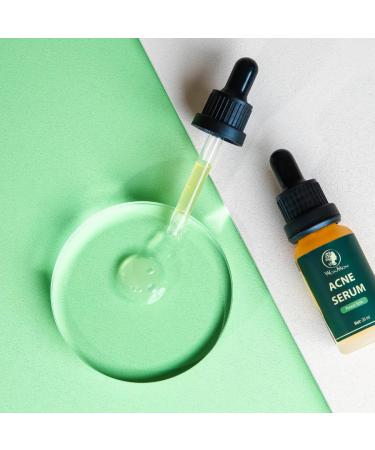 Buy Acne Serum (0.7 fl oz) | Fast International Shipping & Clear Skin Solution - Buy Online on GoSupps.com