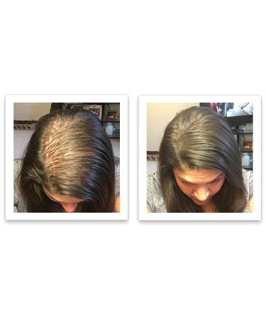 Caboki Hair Loss Concealer - All-Natural Hair Building Fiber for Fuller Hair. Cover Bald Spots and Thinning Areas. Dark Brown (30g) - Buy Online on GoSupps.com
