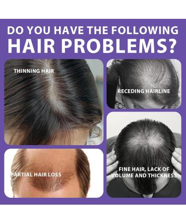 Hairline Powder Hair Thickening Thinning Hair Waterproof Powder Hair Fibers Fuller Hair Hair Concealer Men's Hair Waterproof Hairline Powder For Women Men Instantly Thicker & Fuller Look - Buy Online on GoSupps.com