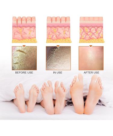 Spray peeling pour les pieds limination des peaux mortes hydratation et claircissement de la peau lissage des pieds secs et fissur s multi-usage pour les mains et les articulations (1PCS) - Buy Online on GoSupps.com