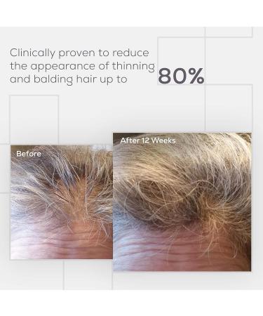 NULASTIN Hair & Scalp Enhancing Serum   Promotes Fuller  Thicker Looking Hair | Follicle Strengthening Formula with Elastin Technology 1.7 Ounce (Pack of 1) - Buy Online on GoSupps.com