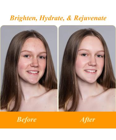 Flawless Body Oil with Papaya Vitamin C & E | Hydrating Oil for Scars Fine Lines & Dark Spots - 200ml - Buy Online on GoSupps.com