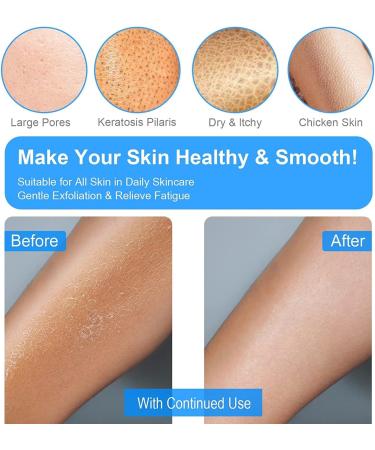 Yiclick Korean Peeling Gloves - Exfoliating Body Scrub Glove for Men & Women | Dead Skin Remover | Blue - Buy Online on GoSupps.com