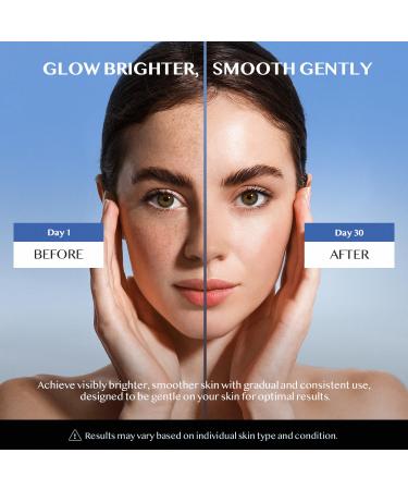 Dark Spot Corrector for Face & Body Niacinamide & Vitamin C Serum for Hyperpigmentation Age Spot Sun Spot Melasma & Freckles Radiance & Even Skin Tone Treatment (1.7 Fl Oz) - Buy Online on GoSupps.com