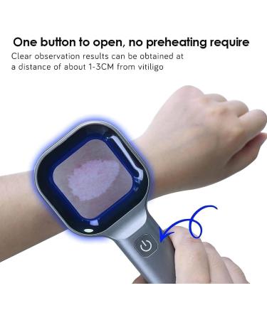 Woods Lamp Skin Analyzer- Visible Lens Area 40 * 40mm Portable Facial Salon Beauty Analyzer Magnifying Analyzer One-Key Operation Rechargeable 365nm for Skin Analyzing Testing Examination - Buy Online on GoSupps.com