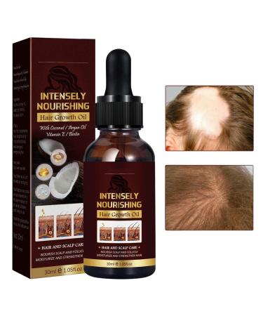 Niktule Hair Growth Essence 30ml Hair Conditioner promotes growth and reduces hair loss - Hair products with rich nutrition reduce hair loss and thinning hair