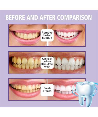 Purple Toothpaste for Teeth Whitening | Color Corrector Foam & Stain Removal | Boost Oral Health & Gum Repair - Buy Online on GoSupps.com