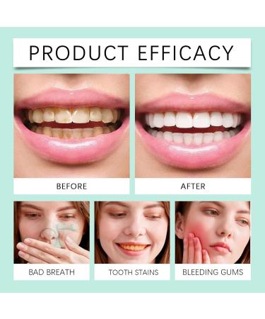 Oral Care Foam Gentle Teeth Cleaning Mousse - Press Type for Fresh Breath Deep Oral Hygiene Daily Morning & Night Use(3PCS) - Buy Online on GoSupps.com