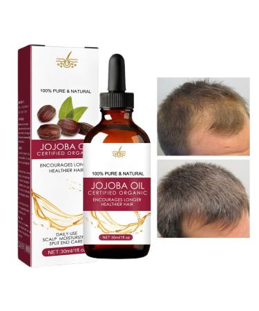 Whnbuij Hair Growth Oil - Natural Hair Oil For Women And Men Regrowth Oil For Thinning Hair | Nourishing Jojoba Oil Anti Frizz Hair Density Oil