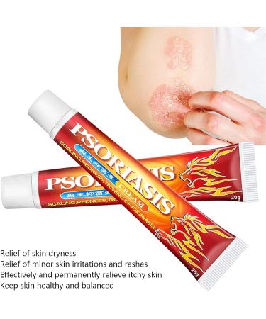 20g Itching Cream | Anti Itch Relief Treatment for Dry Skin Rashes | Men & Women - Buy Online on GoSupps.com