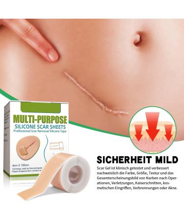 Silicone Scar Sheets - Professional Silicone Paving for Scars 4cm x 150cm Roll Ideal for C-section Burns Keloid & Acne - Medication-Free Solution - Buy Online on GoSupps.com
