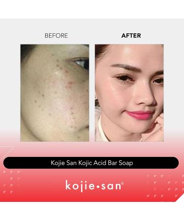 Kojie San Skin Brightening Soap - Original Kojic Acid Soap for Dark Spots & Scars - 3 Bars x 4 Pack - Coconut & Tea Tree Oil - 100g - 4.76 Ounce - Buy Online on GoSupps.com